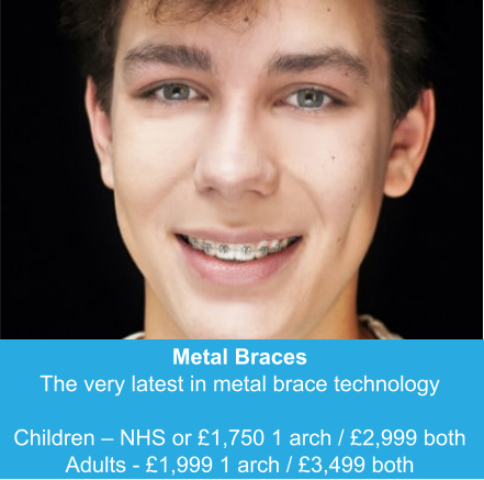 Metal Braces The very latest in metal brace technology  Children – NHS or £1,750 1 arch / £2,999 both Adults - £1,999 1 arch / £3,499 both